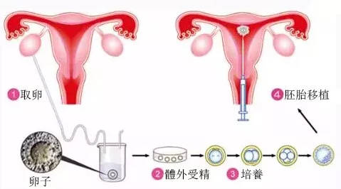 供卵试管婴儿移植前注意事项--注意这五点，提高成功率