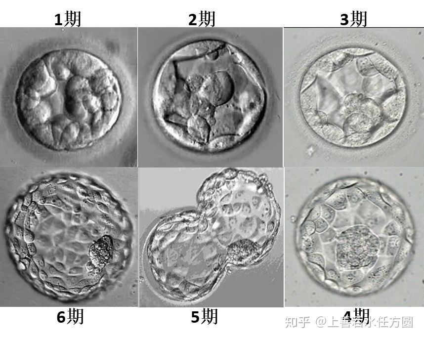 四川成都借卵做试管婴儿费用是多少