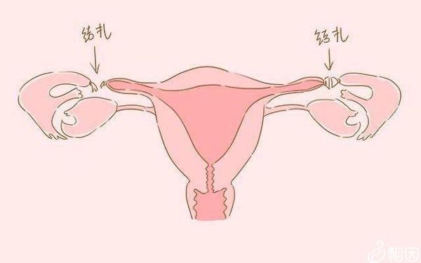 影响供卵试管婴儿中卵泡不破裂的因素有哪些？
