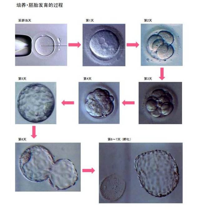 第三代供卵做试管婴儿的全部过程是什么？会不会痛？