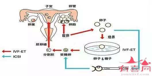 刘诗诗全身臃肿做供卵私立自怀试管，求子之路要经历多少困难？