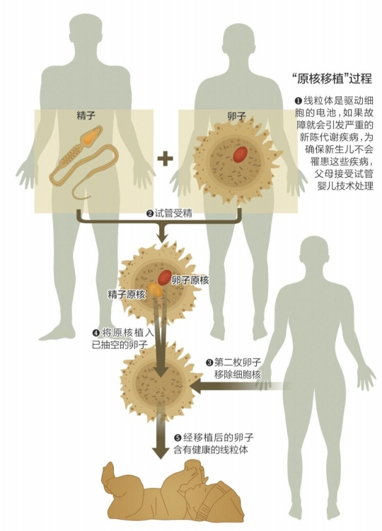什么是做借卵试管供卵的好卵泡？