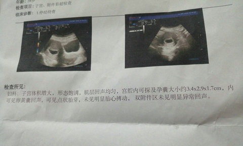 成都哪里可以做赠卵试管三代