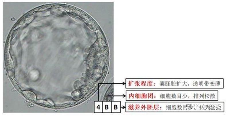 成都市中心医院试管成功经验