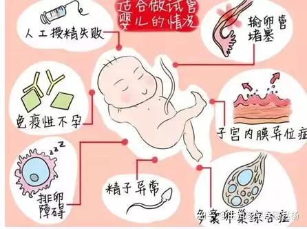 成都卵巢早衰卵巢囊肿影响试管代怀医院哪家好