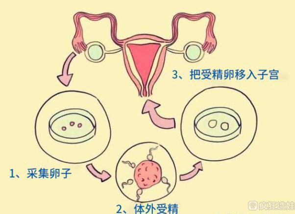 想做试管代怀去哪里好宝宝的流程