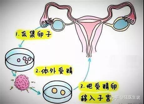 想做试管代怀去哪里好宝宝的流程