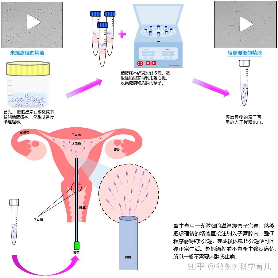 国内借卵试管代怀指南早孕能吃哪些水果-试管代怀性别男孩公司一促一移,顺利助孕二胎王子梦