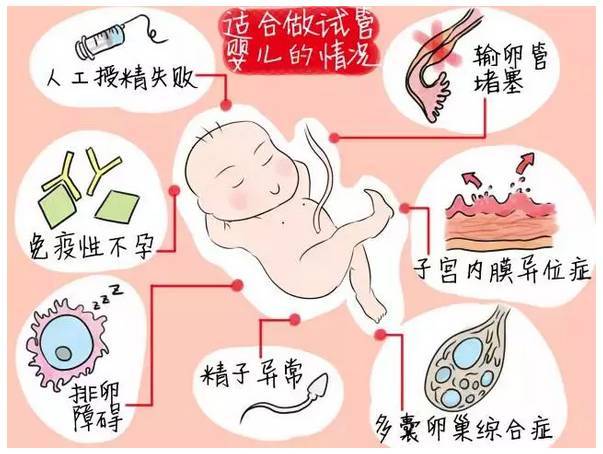 卵巢早衰试管黄体期方案成功率