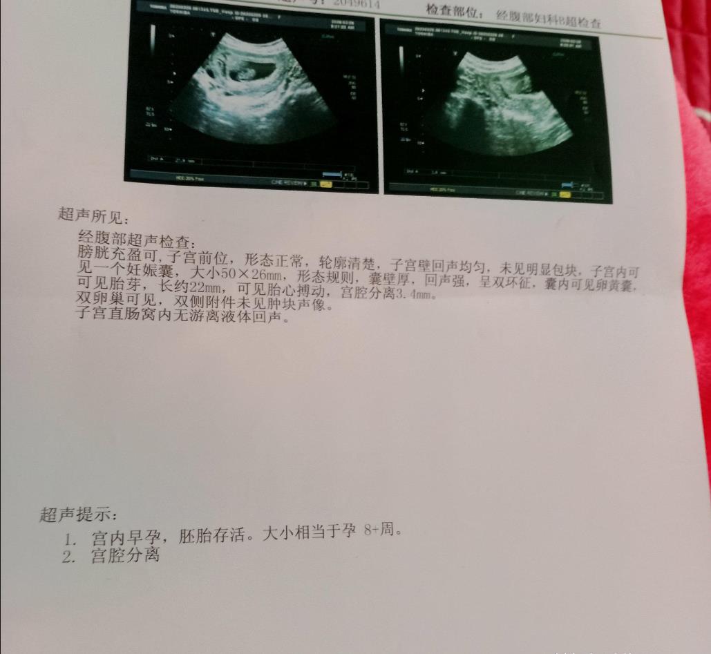 怀孕后孕妇需要注意的生活细节